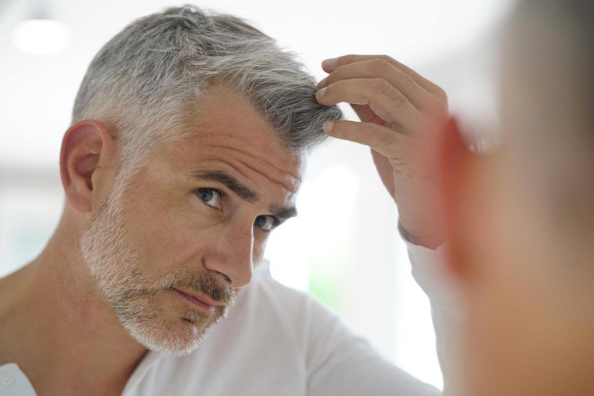 Tabletten Gegen Haarausfall Männer